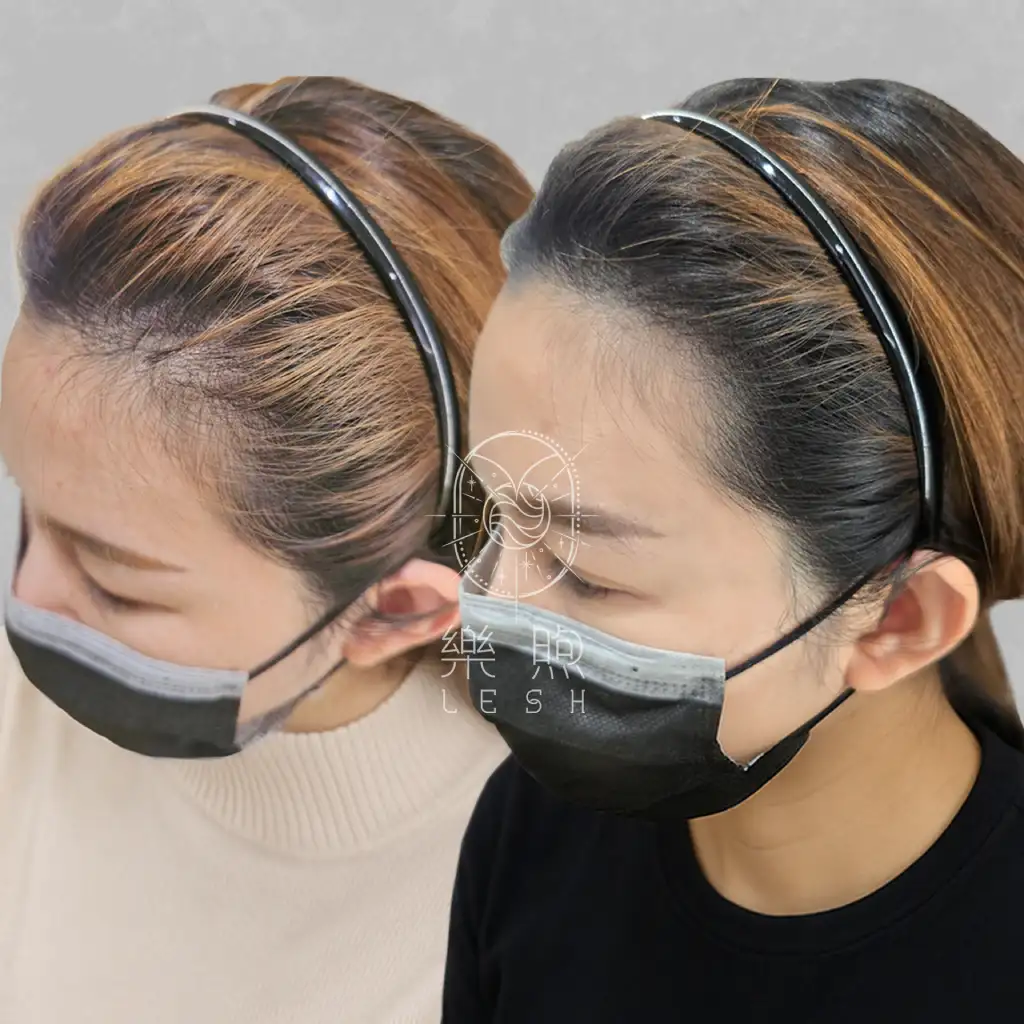 樂煦SMP女性髮際線紋髮
