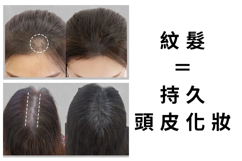 紋髮可以想樣成是持久的頭皮化妝，靠著精密的頭皮上色技術，造出自然的髮量感