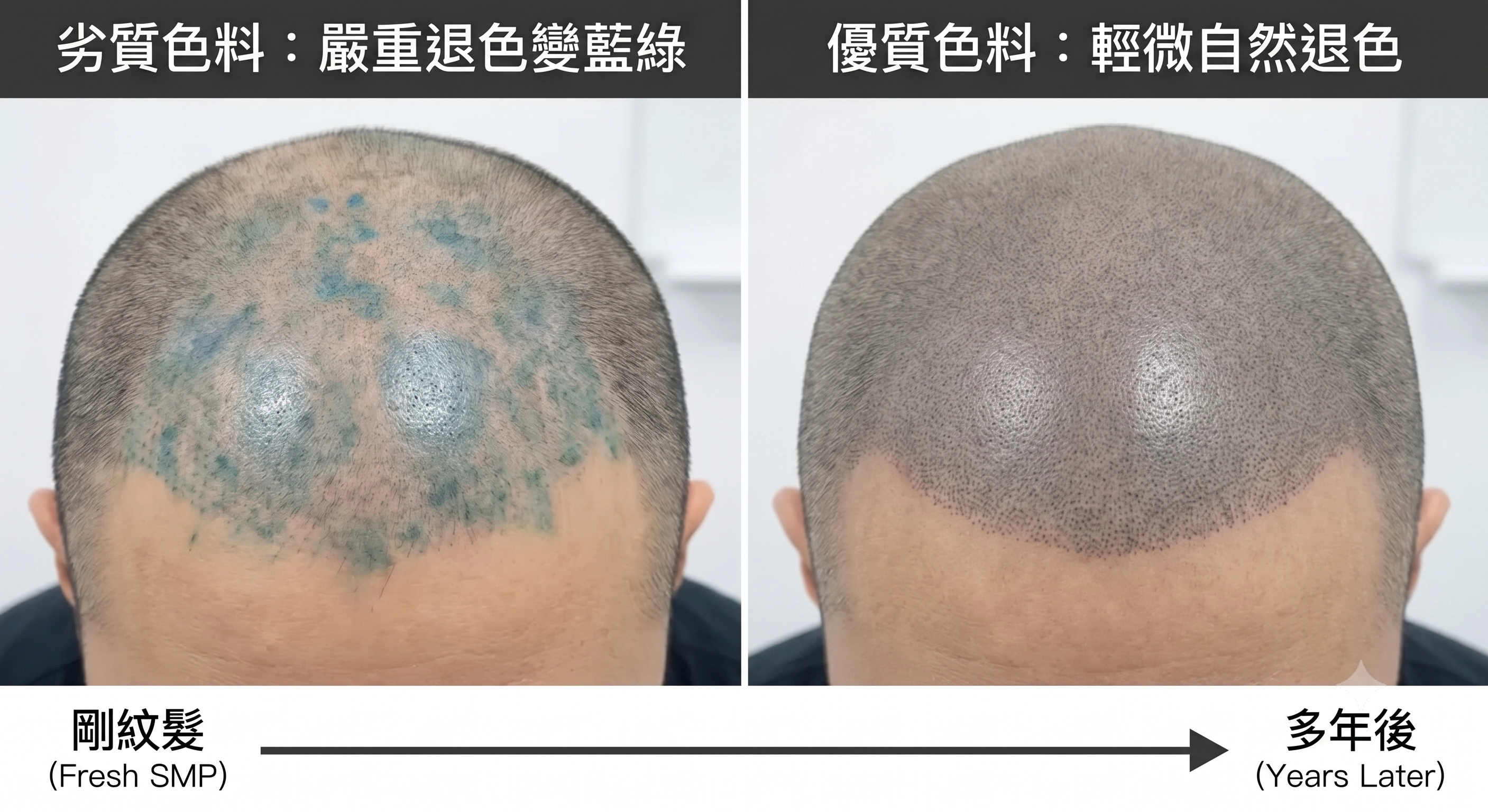 劣質紋髮色料退色變藍綠 vs 紋髮品質好只有輕微退色