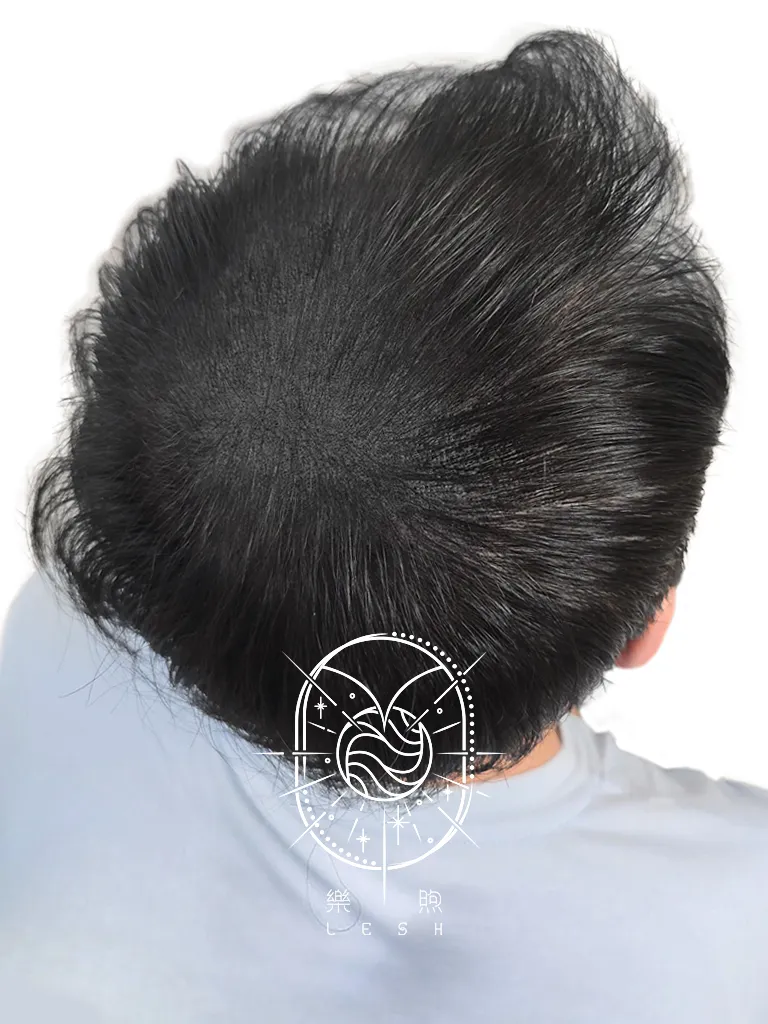 樂煦頭頂紋髮_後